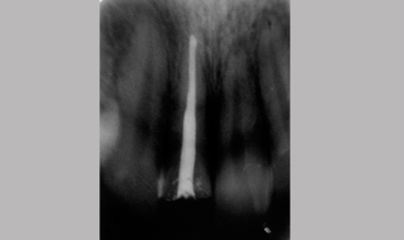 Oral surgery in Anand                        